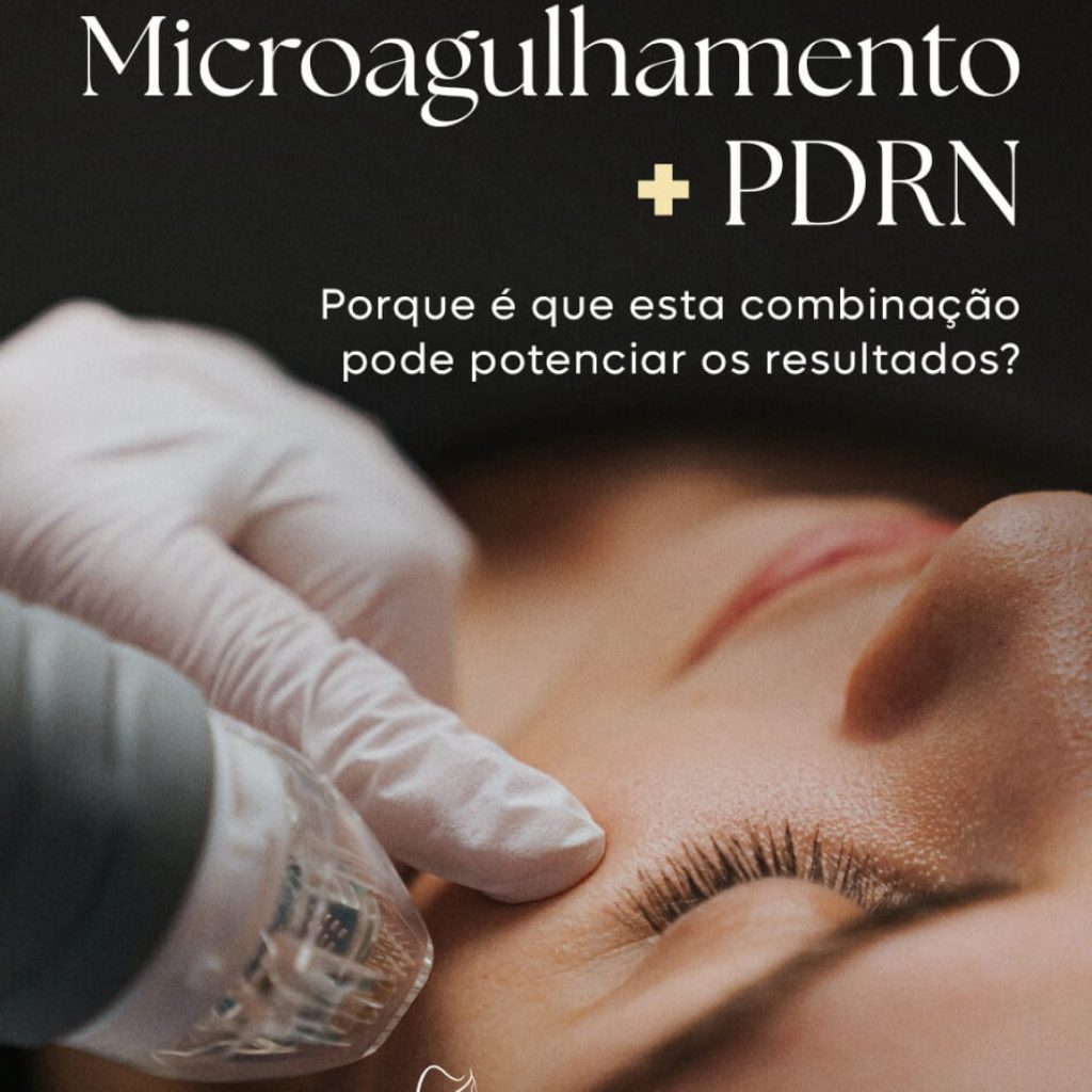 microagulhamento+PDRN